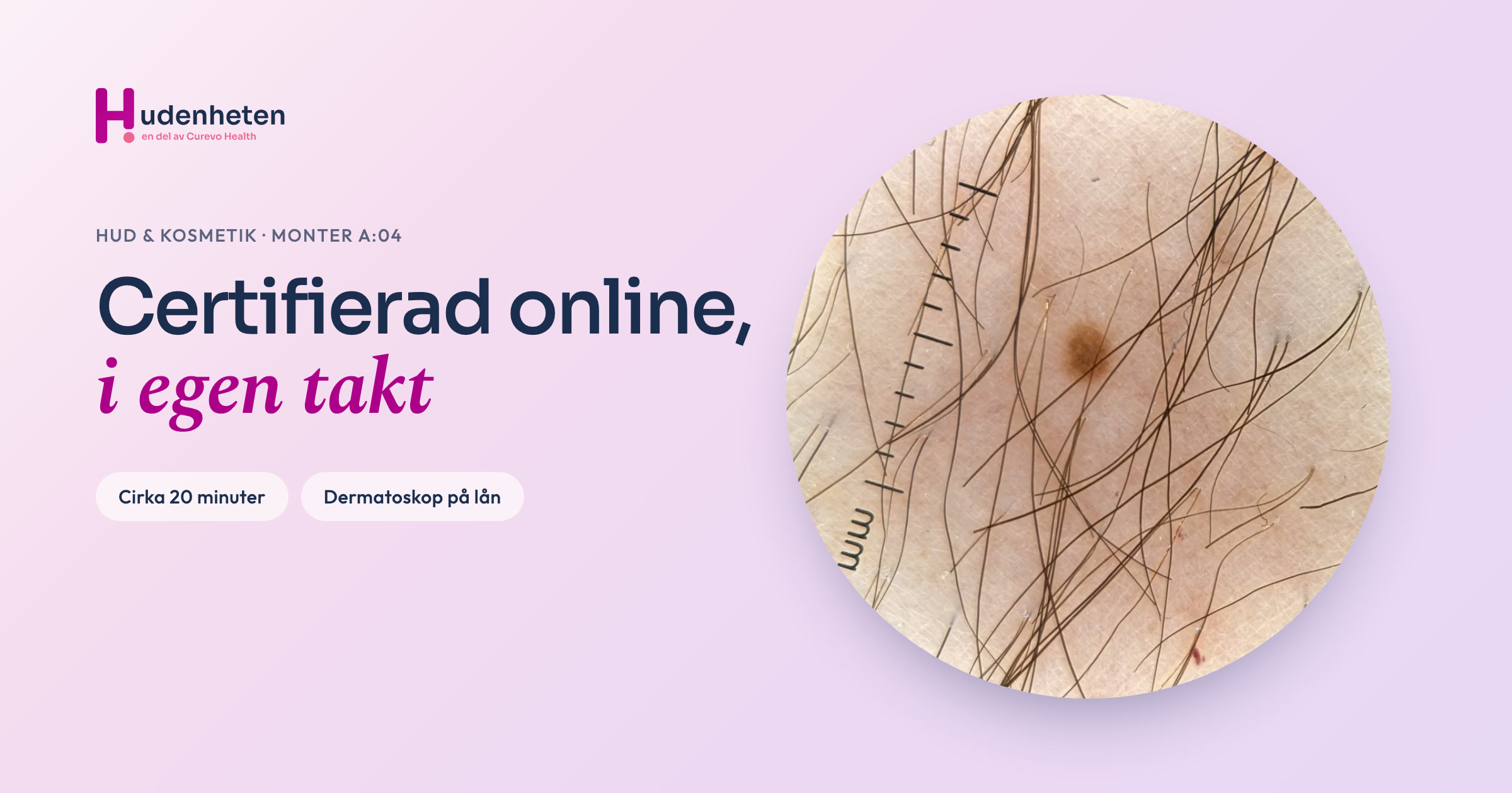 Dermatoskopibild av ett födelsemärke med millimeterskala