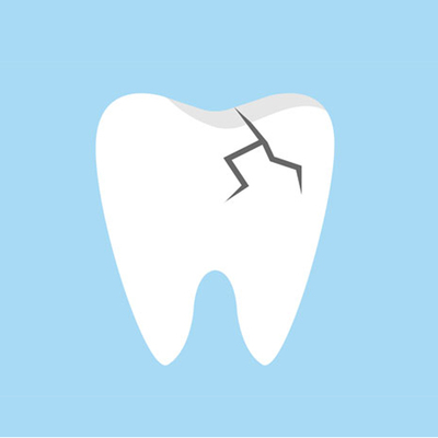 Profilbild för Symptomgivande sprickor i tanden – endodonti möter protetik